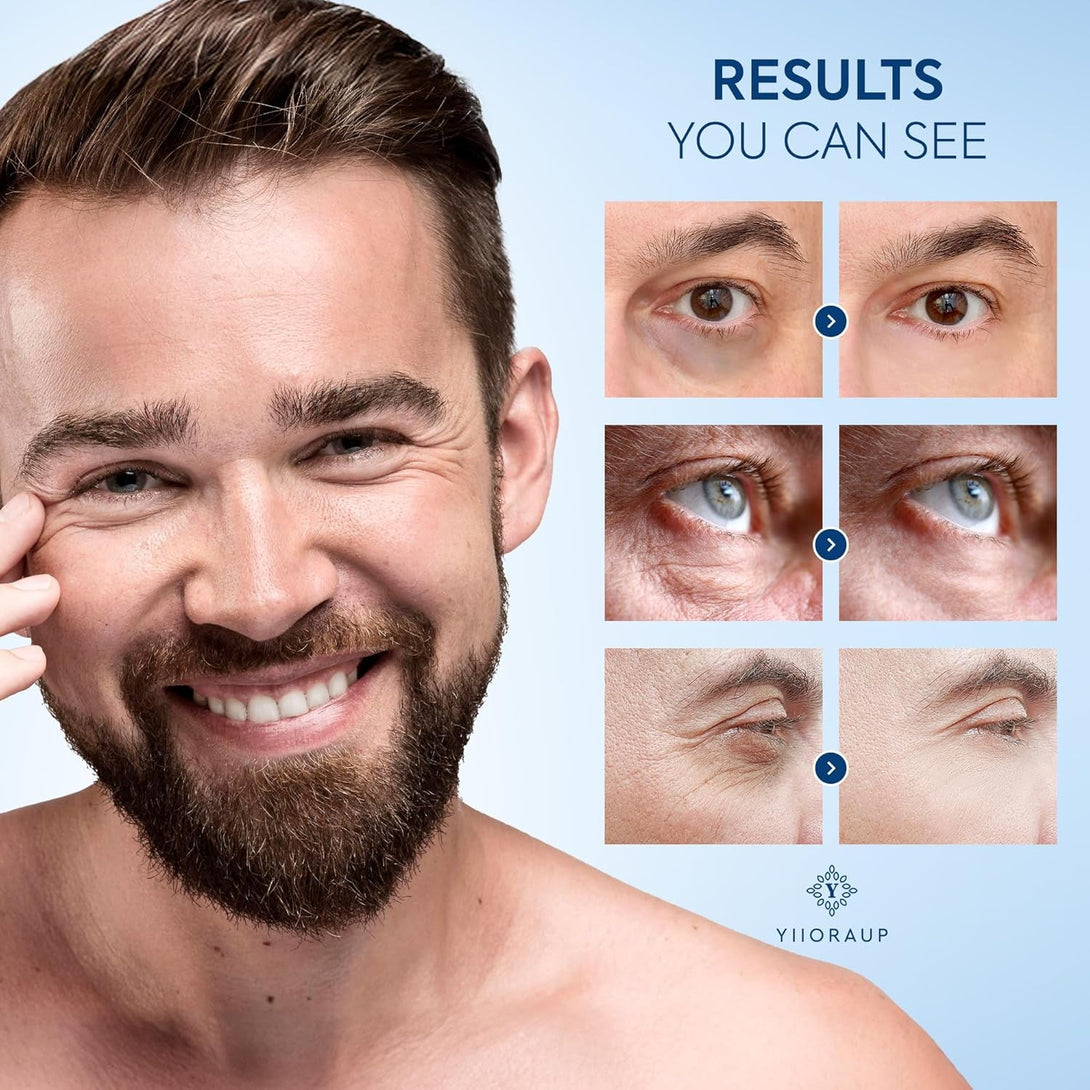 Caffeine Eye Cream for Men: under Eye Roller for Bags and Puffy Eyes Treatment - Men'S Cooling Stick and Depuffer for Dark Circles and Puffiness