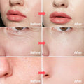 SORYA Skin Care Retinol Facial Moisturizer Hydrating with Hyaluronic Acid, Skincare Face Cream to Reduce Wrinkles Powerful Day and Night
