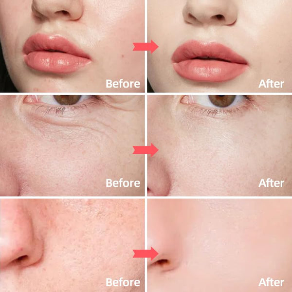 SORYA Skin Care Retinol Facial Moisturizer Hydrating with Hyaluronic Acid, Skincare Face Cream to Reduce Wrinkles Powerful Day and Night