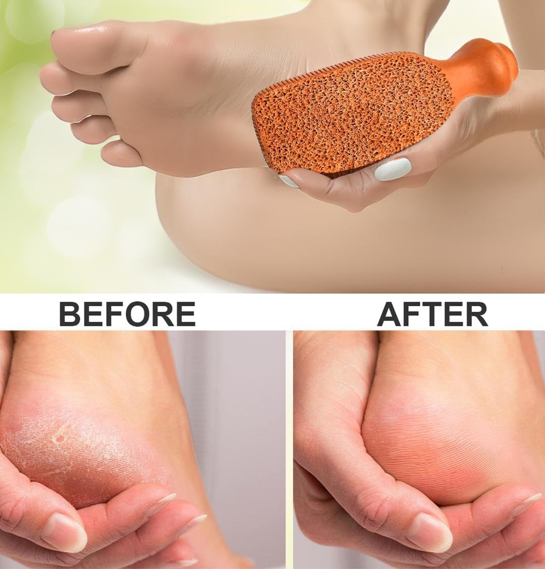 QUBA LINEN Pumice Stone for Feet - 2-Sided Terra Cotta Foot Scrubber, Professional Exfoliating Clay Stone for Feet Hands Body Care - Pumice Stone for Feet Callus Remover, Brown