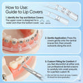 Comfort Covers for Braces - Orthodontic Mouth Guard, Lip Protector, Wax Alternative, Lip Shield for Brackets