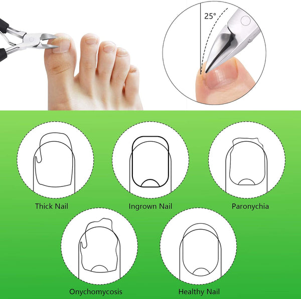 Feiccier Heavy Duty Ingrown Toenail Clippers, Professional Toenails Trimmer, Podiatrist Toe Nail Clippers for Thick Nail & Ingrown Toenails, Sharp
