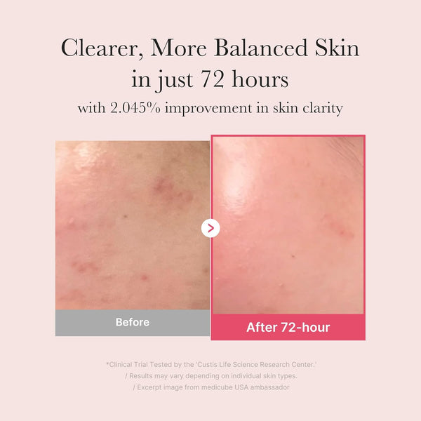 Medicube Txa+Niacinamide 15% Glow Facial Serum for after Spot Care | All-In-One Daily Korean Skincare | Uneven Skin Tone, Texture, and Hydration