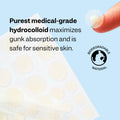 Peach Slices | Acne Spot Dots | Hydrocolloid Acne Patches | for Zits, Blemishes, & Breakouts | Vegan | Cruelty-Free | Pimple Patches | Facial Skin