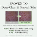 Korean Rice Mochi Face Cleanser - Face Mask, Foaming Cleanser, Gentle Scrub All in One - Deep Cleansing, Moisturizing, Pore Minimizing, Removing