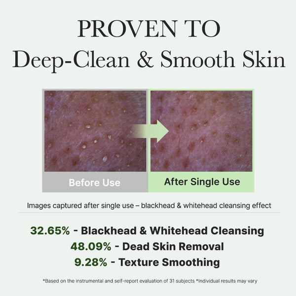 Korean Rice Mochi Face Cleanser - Face Mask, Foaming Cleanser, Gentle Scrub All in One - Deep Cleansing, Moisturizing, Pore Minimizing, Removing