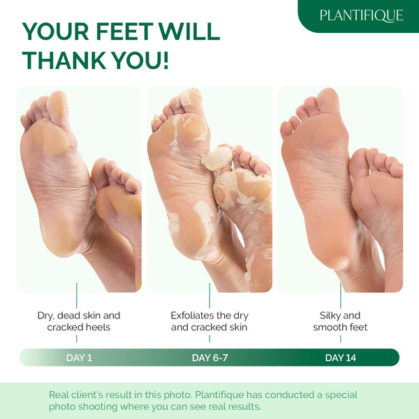 PLANTIFIQUE Foot Peeling Mask for Men, Dermatologically Tested - 2 Pairs Aloe Vera 1 Count (Pack of 2)