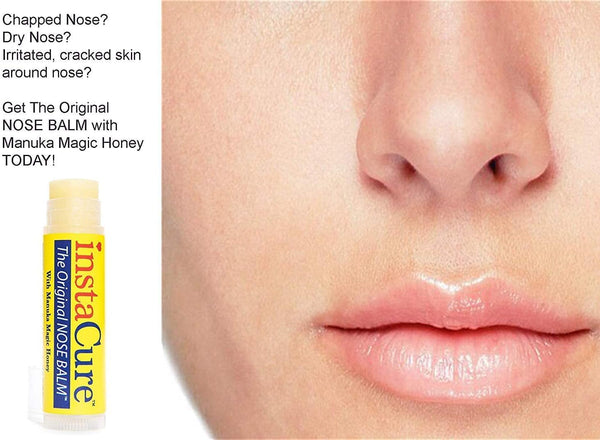 Original Nose Balm. Fast Relief for Cracked Dry & Sore Noses with Raw Manuka Honey Vitamin E Shea Butter Aloe Vera Oil. Heals DogÃ¢ÂÂS Dry Cracked