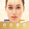 Under Eye Patches, 40 Pairs Eye Mask for Dark Circles, Puffy Eyes, Undereye Bags,Wrinkles,Eye Mask Patches with 24K Gold, Hyaluronic Acid,Rose &