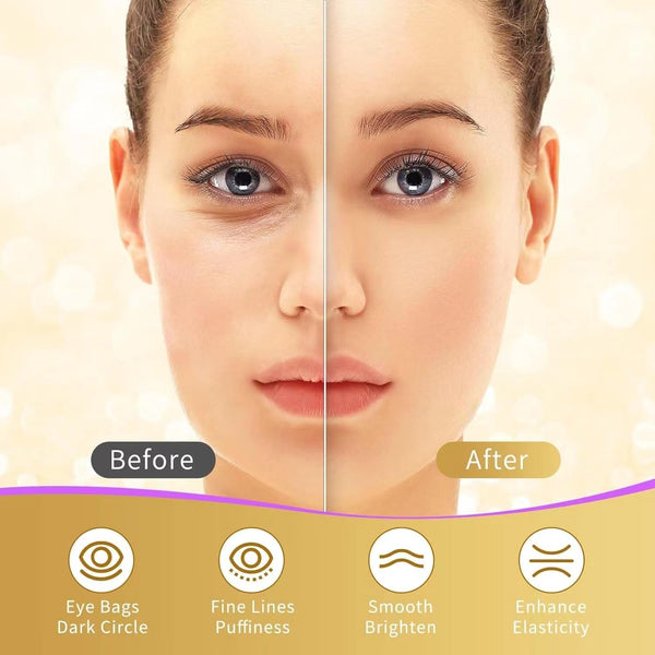 Under Eye Patches, 40 Pairs Eye Mask for Dark Circles, Puffy Eyes, Undereye Bags,Wrinkles,Eye Mask Patches with 24K Gold, Hyaluronic Acid,Rose &