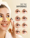 Maskiss 24k Gold Under Eye Patches (30 Pairs), Eye Mask, Collagen Skin Care Products, Eye Patches for Puffy Eyes, Eye Masks for Dark Circles and