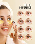 Maskiss 24k Gold Under Eye Patches (50 Pairs), eye mask, Collagen Skin Care Products, Eye Patches for Puffy Eyes, eye masks for dark circles and