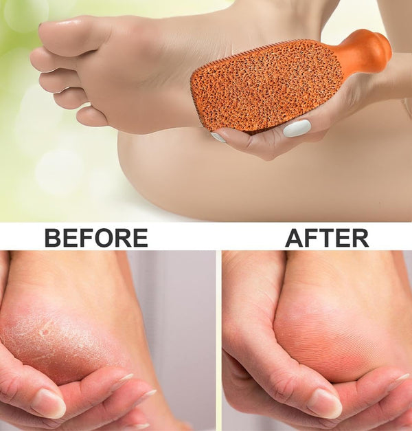 QUBA LINEN Pumice Stone for Feet – 2-Sided Terra Cotta Foot Scrubber, Natural Callus Remover for Dry Skin & Rough Heels, Cracked Heels – Pedicure