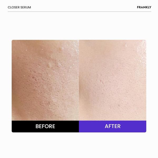 FRANKLY Closer Serum Jumbo | Pore Minimizer Serum | 2.03 fl oz | 9 Peptides, Vegan Collagen, Adenosine, PHA | Korean Pore Minimizer for Glass