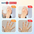 Fast-Acting Wart Remover - Effective Plantar and Genital Wart Removal with Natural Ingredients - Attacks Warts on Contact, Easy Dropper