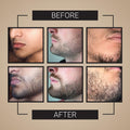 Crafted Beards Beard Growth Oil Serum - 1 fl Oz - Unscented - Helps Grow A Thicker Beard, Improves Beard Health, Fills in Thin and Patchy Spots -