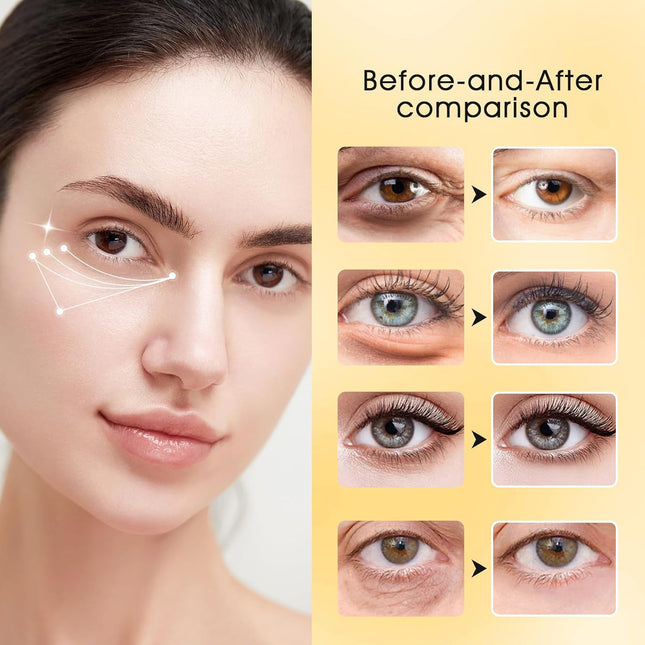 Adofect 30 Paris under Eye Patches 24K Gold under Eye Mask for Puffy Eyes and Dark Circles Treatments, under Eye Bags Tr