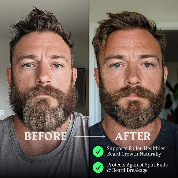 Striking Viking Beard Growth Oil with Biotin - 2 Fl Oz, Unscented - Thickening, Conditioning Biotin Beard Growth Serum for Men with Argan & Jojoba