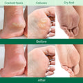 PLANTIFIQUE Foot Peeling Mask for Men, Dermatologically Tested - 2 Pairs Aloe Vera 1 Count (Pack of 2)