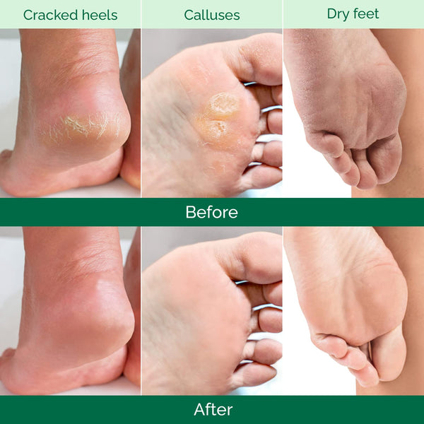 PLANTIFIQUE Foot Peeling Mask for Men, Dermatologically Tested - 2 Pairs Aloe Vera 1 Count (Pack of 2)