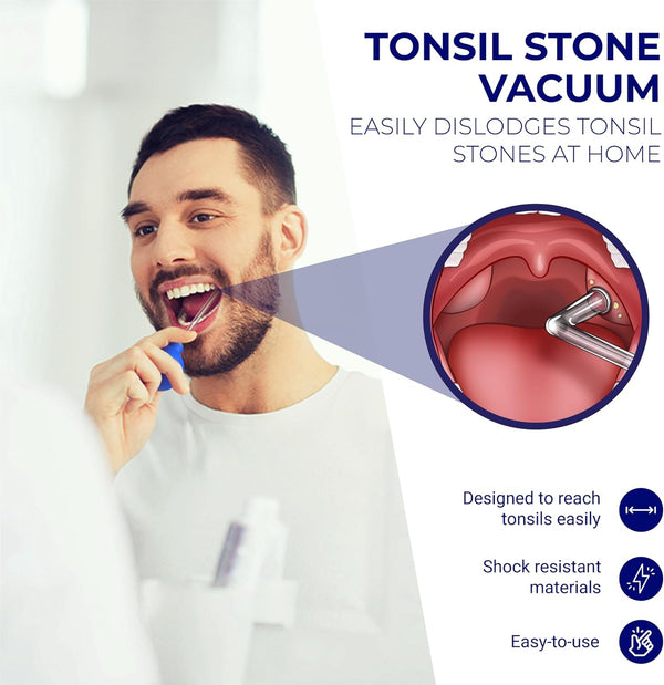 Oravix Tonsil Stone Vacuum, Tonsil Stone Remover Vacuum Suction, Tonsil Stone Cupping Tool, Tonsil Stone Removal Tool with Suction, Tonsil Stones