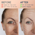 AURUZA 2 Rolls Facial Myofascial Face Lift Tape, Neck & Forehead Smooths Wrinkles, Unisex Anti-Wrinkle Patches for Firming And Tightening Skin