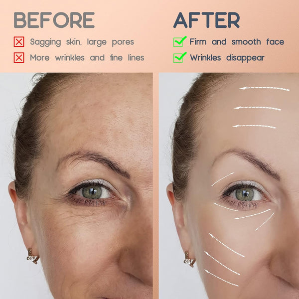 AURUZA 2 Rolls Facial Myofascial Face Lift Tape, Neck & Forehead Smooths Wrinkles, Unisex Anti-Wrinkle Patches for Firming And Tightening Skin