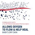 Aquaphor Healing Ointment, 14 Oz (396 G) 14 Ounce (Pack of 1)