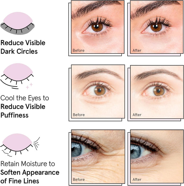 Grace & Stella under Eye Patches (12 Pairs) - Birthday Gifts for Women - Travel Essentials - Eye Masks for Puffy Eyes and Dark Circles -