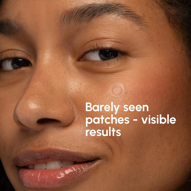 MAREE Pimple Patches for Face - Clear Acne Patches for Face - Invisible Hydrocol