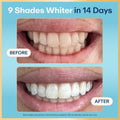 Lumineux Teeth Whitening Strips, Peroxide Free, 21 Treatments (3 Months) | Peroxide free, enamel safe, dentist formulated, clinically tested &