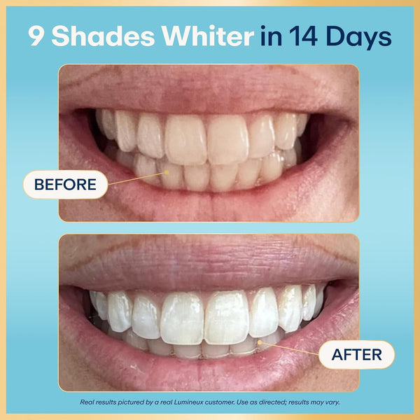 Lumineux Teeth Whitening Strips, Peroxide Free, 21 Treatments (3 Months) | Peroxide free, enamel safe, dentist formulated, clinically tested &