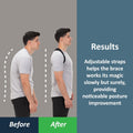 Comfybrace Posture Corrector-Back Brace for Men and Women- Fully Adjustable Straightener for Mid, Upper Spine Support- Neck, Shoulder, Clavicle