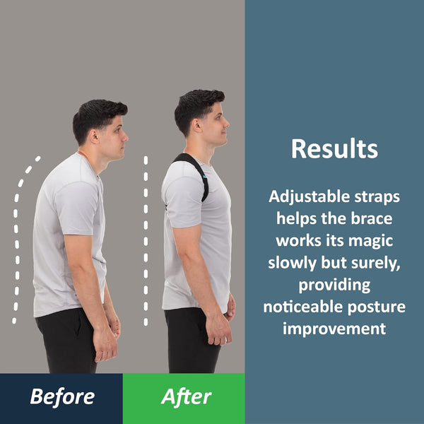 Comfybrace Posture Corrector-Back Brace for Men and Women- Fully Adjustable Straightener for Mid, Upper Spine Support- Neck, Shoulder, Clavicle