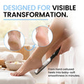 Colossal Foot rasp Foot File and Callus Remover. Best Foot Care Pedicure Metal Surface Tool to Remove Hard Skin. Can be Used on Both Wet and Dry
