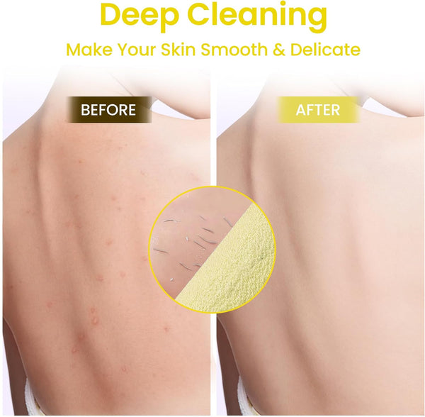 Silkyhose 3Pcs Dual-Sided Exfoliating Stretch Back Scrubber with Handles. | Reusable Shower Essential. Deep Skin Cleansing. Textured Design. Soft,