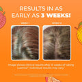 Maryruth'S Liquid Multivitamin + Hair Growth | Biotin 10000Mcg | Lustriva Hair Growth Supplement | Clinically Tested in Women for Thicker Hair &