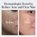 Geologie Daily Face Wash for Sensitive Skin | Fragrance-Free Facial Cleanser for Men & Women | Acne & Oil Control | Non-irritating, Gentle