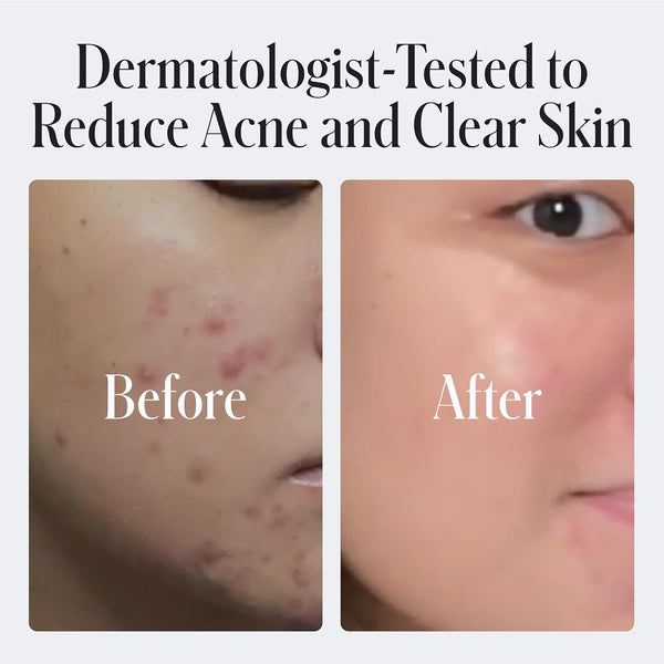 Geologie Daily Face Wash for Sensitive Skin | Fragrance-Free Facial Cleanser for Men & Women | Acne & Oil Control | Non-irritating, Gentle
