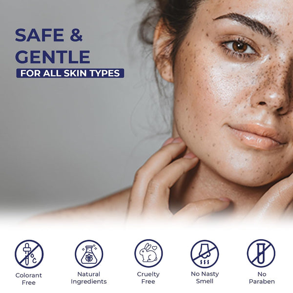 Melasma Treatment for Face - Melasma Cream & Age Spot Remover for Skin Discoloration, Post-Blemish Marks, Scars & Spots | Dark Spot Remover for