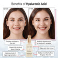 grace & stella Award Winning Hyaluronic Acid Serum (50ml/1.7 fl oz) Hydrating Hyaluronic Acid Serum for Face - Acido Hialuronico for Women -