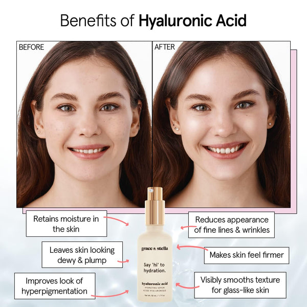 grace & stella Award Winning Hyaluronic Acid Serum (50ml/1.7 fl oz) Hydrating Hyaluronic Acid Serum for Face - Acido Hialuronico for Women -
