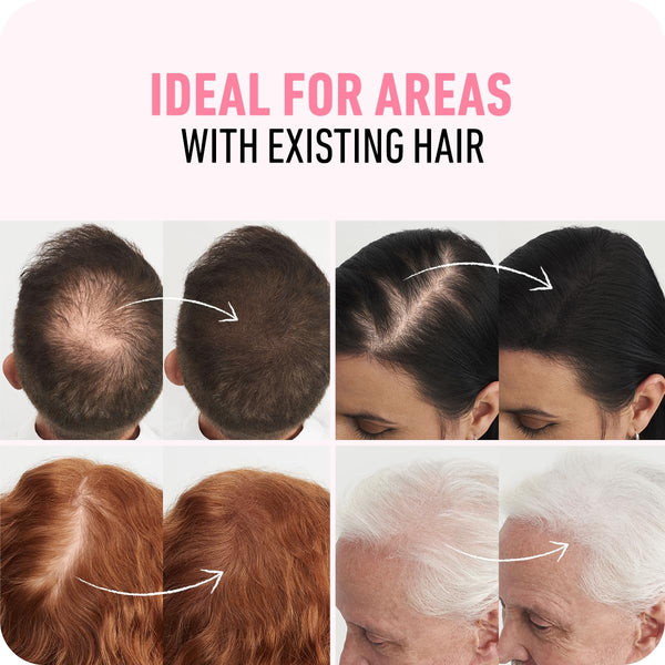 BOLDIFY Hair Fibers - Fill In Thinning and Fine Hair for an Instantly Fuller, Thicker Look - 14 Shades for Women & Men (Black, 12g) 12g Black