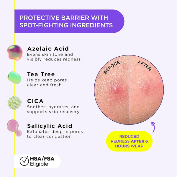 ZitSticka Liquid Pimple Patch - Invisible Pimple Patches for Face, Pimple Cream, Salicylic Acid Spot Cover For Face, Liquid Pimple Patch Large &