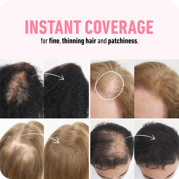 BOLDIFY Hair Fibers - Fill In Thinning and Fine Hair for an Instantly Fuller, Thicker Look - 14 Shades for Women & Men (Black, 12g) 12g Black