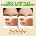SILKDERMIS Forehead Wrinkle Patches 12Pcs with Smile Line Patches 24Pcs with Aloe, Collagen, Vitamin E, Forehead Wrinkles Treatment and Smile