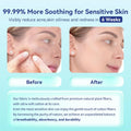 Disposable Face Towels,Ultra Thick Face Towelettes XL, Lint-Free Facial Wipes for Makeup Removal & Gentle Skin Care,50 Count, 10"ÃÂ12",