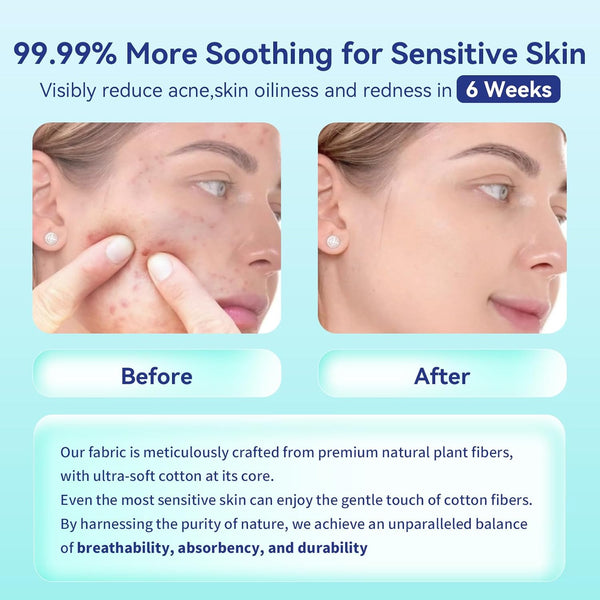 Disposable Face Towels,Ultra Thick Face Towelettes XL, Lint-Free Facial Wipes for Makeup Removal & Gentle Skin Care,50 Count, 10"ÃÂ12",