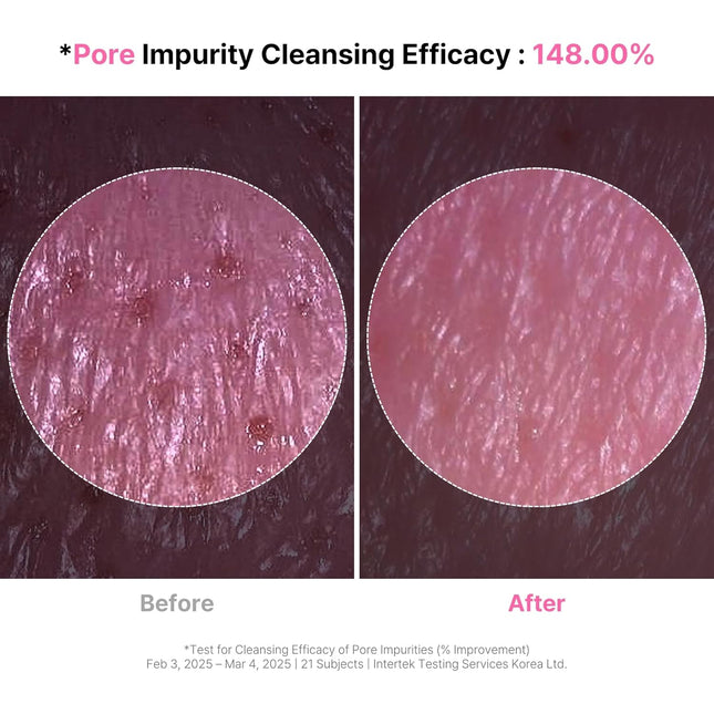 4-In-1 Konjac Jelly Face Cleanser â Gentle Daily Exfoliating, Deep Cleansing, Pore Care & Makeup Removal | Berry Smoot