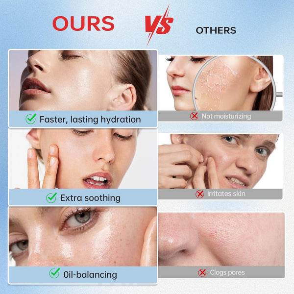 VGO Snail Mucin 92% Moisturizer Daily Face Moisturizer Hydrating Repair Face Gel Cream for Dry & Sensitive Skin, All Skin Types 50g / 1.76oz 1.76